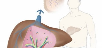 Ziua Mondială de Luptă împotriva Hepatitei: „Opreşte hepatita: aceasta depinde de tine”