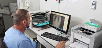 Circa 2500 de persoane au făcut screening pulmonar gratuit, la două săptămâni de la lansarea campaniei „Un doctor pentru tine”