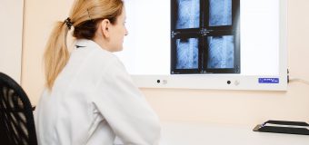 (VIDEO) Cetăţenii din grupurile de risc pot efectua gratis radiografia cutiei toracice