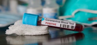 258 cazuri noi de infectare cu Coronavirus și 8 decese