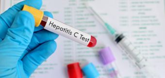 A fost lansată testarea de screening la hepatitele virale B și C cu Teste Rapide de Diagnostic