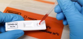 Teste rapide antigen utilizate în SUA și UE, aprobate de Agenția Medicamentului