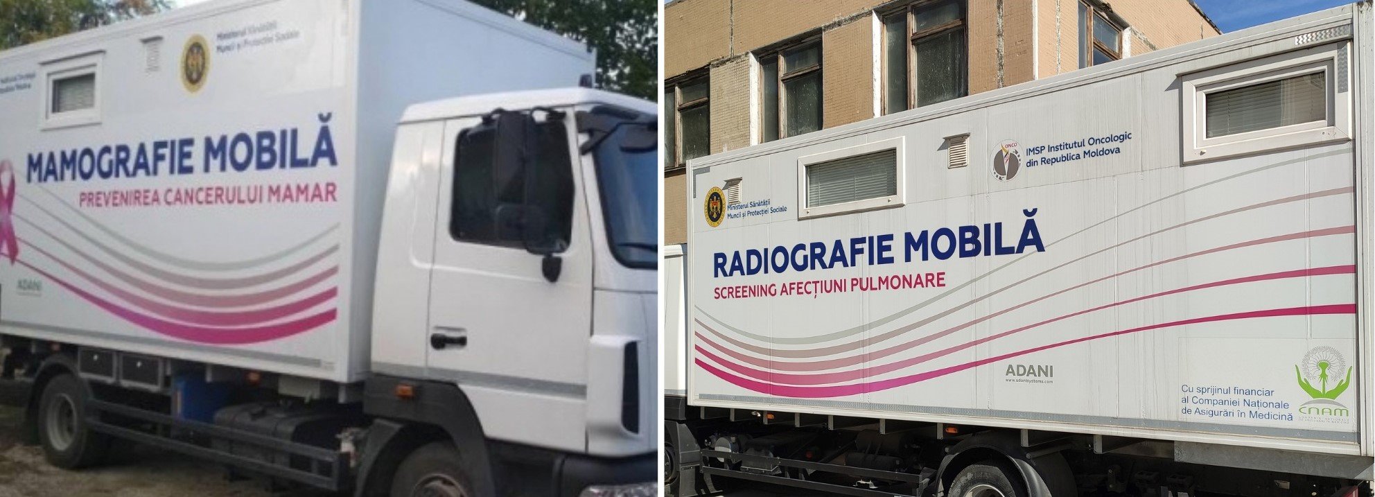 Complexul radiodiagnostic mobil pentru examinarea cutiei toracice se va afla în raionul Șoldănești în această săptămână