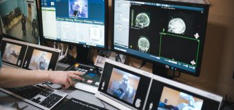 Ministerul Sănătății pregătește procurarea unui al doilea aparat modern pentru tratament radiologic