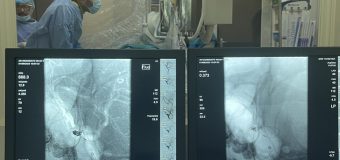 O echipă de medici au salvat viața unui tânăr