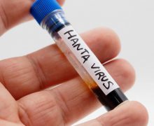 Infecția cu hantavirus: Nivelul de risc pentru sănătatea publică